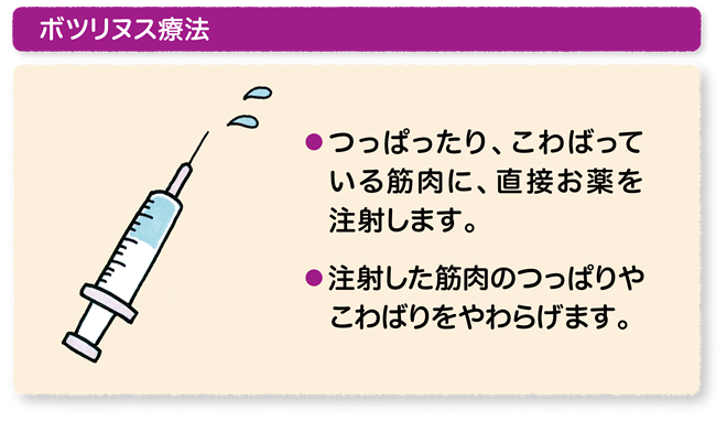 ボトックス
